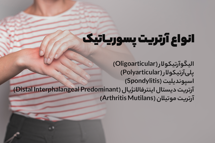 انواع آرتریت پسوریاتیک